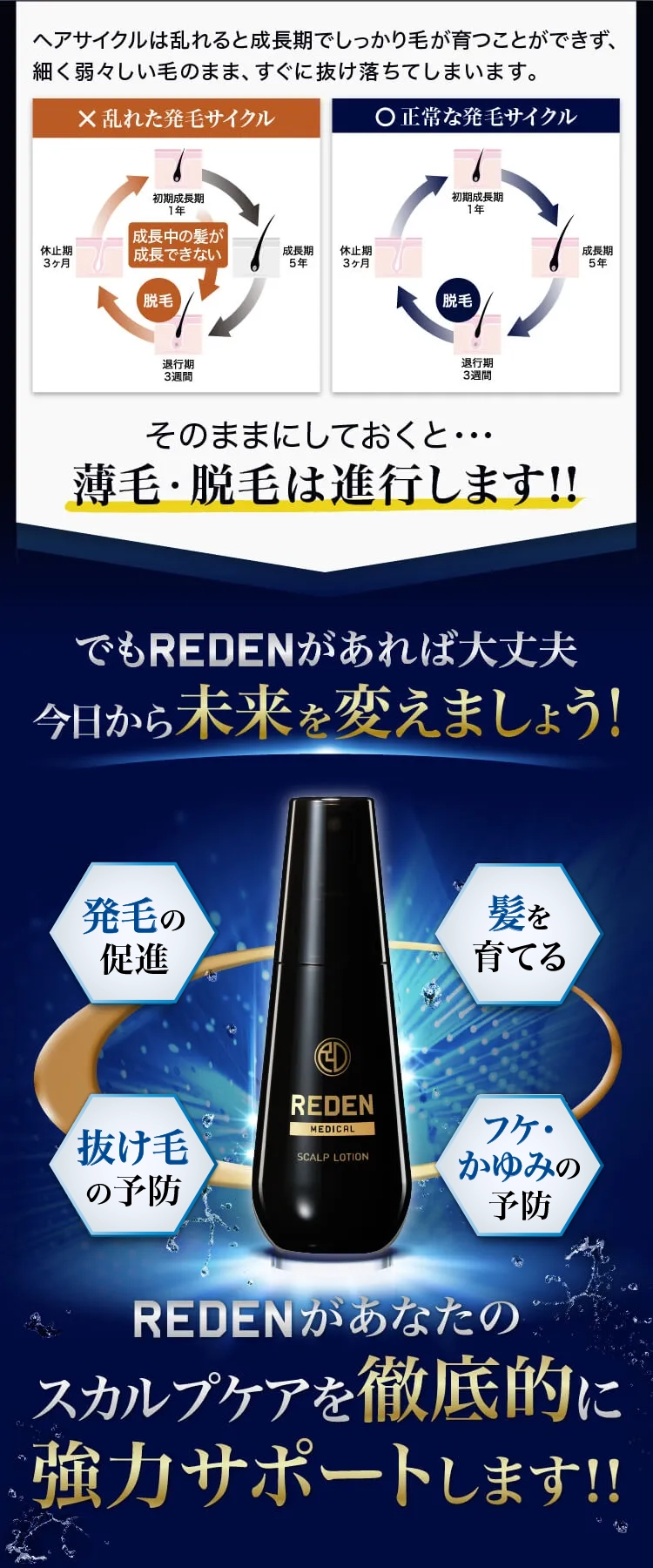 忙しい毎日は薄毛の原因で溢れています